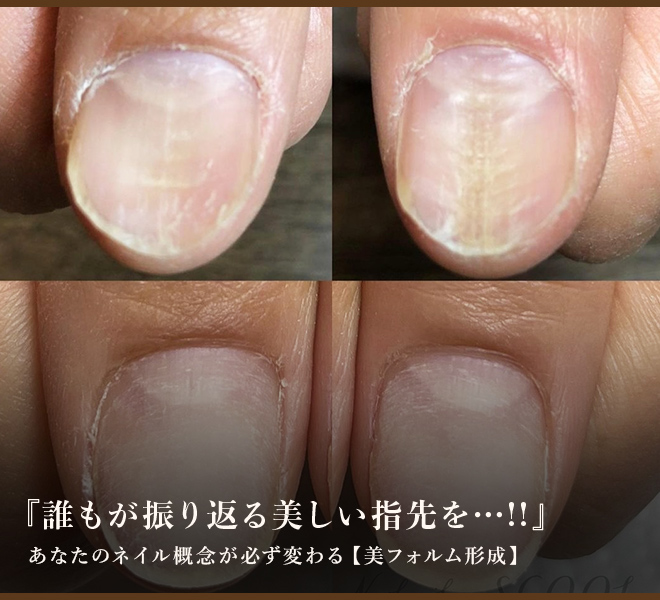 自爪育成 Nail salon SCOOL